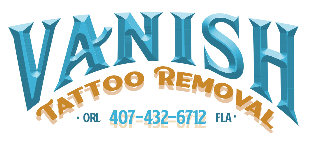 Vanish Tattoo Removal